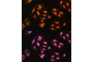 Immunofluorescence analysis of U2OS cells using  Rabbit pAb (ABIN1678593, ABIN3018971, ABIN3018972 and ABIN6220651) at dilution of 1:100. (ADRM1 Antikörper  (AA 108-407))