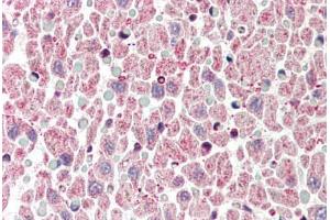 Human Heart (formalin-fixed, paraffin-embedded) stained with BCL2L1 antibody ABIN214407 at 2.