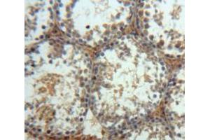 Used in DAB staining on fromalin fixed paraffin-embedded Testis tissue (MAPK10 Antikörper  (AA 88-332))