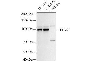 Western blot analysis of extracts of various cell lines, using PLOD2/LH2 antibody (ABIN6132888, ABIN6145788, ABIN6145790 and ABIN6222693) at 1:1000 dilution. (PLOD2 Antikörper  (AA 470-650))