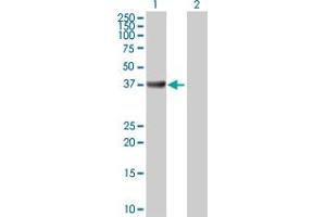 Western Blot analysis of ADA expression in transfected 293T cell line by ADA MaxPab polyclonal antibody. (ADA Antikörper  (AA 1-363))