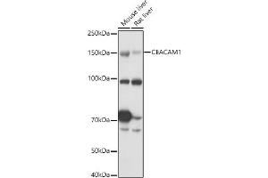 Western blot analysis of extracts of various cell lines, using CE antibody (ABIN3015546, ABIN3015547, ABIN3015548 and ABIN6218802) at 1:1000 dilution. (CEACAM1 Antikörper  (AA 300-430))