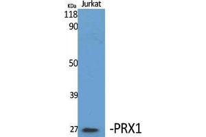 Western Blotting (WB) image for anti-Paired Related Homeobox 1 (PRRX1) (Internal Region) antibody (ABIN3186573) (PRRX1 Antikörper  (Internal Region))
