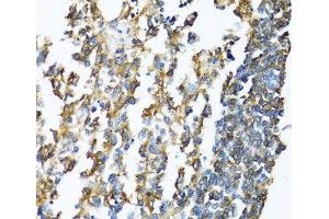 Immunohistochemistry of paraffin-embedded Human lymphonodus using HLA-DPB1 Polyclonal Antibody at dilution of 1:100 (40x lens).