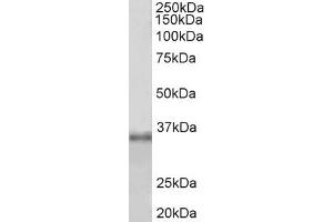 Western Blotting (WB) image for anti-Fibrillarin (FBL) (AA 121-135) antibody (ABIN1101486) (Fibrillarin Antikörper  (AA 121-135))