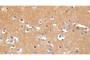 Immunohistochemistry of paraffin-embedded Human brain tissue using LRP3 Polyclonal Antibody at dilution 1:80 (LRP3 Antikörper)