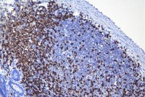IHC analysis of CD5 using anti-CD5 antibody (ABIN7600839). (CD5 Antikörper  (AA 24-494))