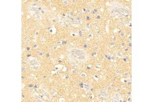 Immunohistochemistry analysis of paraffin embedded mouse brain using PPP2R2C (ABIN7075278) at dilution of 1: 500 (PPP2R2C Antikörper)