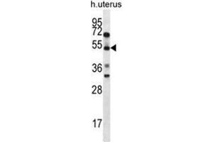 ABRA Antibody (C-term) western blot analysis in human normal Uterus cell line lysates (35ug/lane). (ABRA Antikörper  (C-Term))