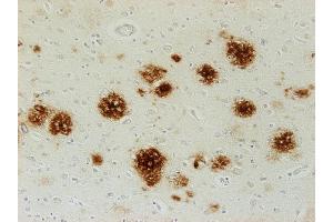 Immunostaining of paraffin embedded brain section from an Alzheimer´s patient (dilution 1 : 500). (Abeta 38/40/42 (AA 1-16), (AA 4-16) Antikörper)