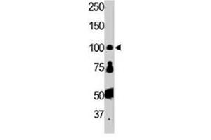 The FER polyclonal antibody  is used in Western blot to detect FER in HL-60 cell lysate. (FER Antikörper  (AA 789-818))