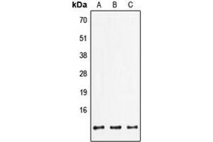 Western blot analysis of FXYD2 expression in HepG2 (A), mouse lung (B), rat brain (C) whole cell lysates.
