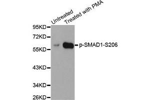 Western blot analysis of extracts from HeLa cells using Phospho-SMAD1-S206 antibody (ABIN2987857). (SMAD1 Antikörper  (pSer206))