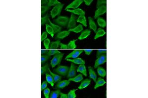 Immunofluorescence analysis of A549 cells using IFNA1 antibody (ABIN5970112). (IFNA1 Antikörper)