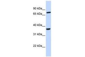 Image no. 1 for anti-Chemokine (C-C Motif) Receptor-Like 2 (CCRL2) (AA 36-85) antibody (ABIN6740363) (CCRL2 Antikörper  (AA 36-85))