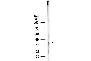 anti-Chemokine (C-C Motif) Receptor-Like 1 (CCRL1) (C-Term) antibody