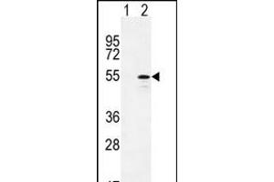 Western blot analysis of CYP26B1 (arrow) using rabbit polyclonal CYP26B1 Antibody (C-term) (ABIN392528 and ABIN2842083). (CYP26B1 Antikörper  (C-Term))