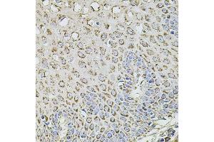 Immunohistochemistry (IHC) image for anti-Transmembrane Channel-Like 1 (TMC1) (AA 600-700) antibody (ABIN6149240)