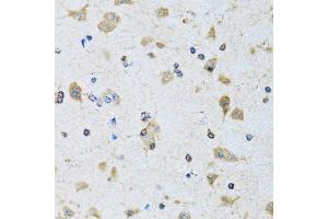 Immunohistochemistry of paraffin-embedded rat brain using PDP1 antibody (ABIN6132860, ABIN6145404, ABIN6145405 and ABIN6221944) at dilution of 1:100 (40x lens). (PDP Antikörper  (AA 278-537))