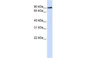 DCLRE1C antibody used at 1 ug/ml to detect target protein. (DCLRE1C Antikörper)