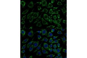 Immunofluorescence analysis of L929 cells using IDH3B Polyclonal Antibody (ABIN6128145, ABIN6142149, ABIN6142150 and ABIN6217848) at dilution of 1:100 (40x lens).