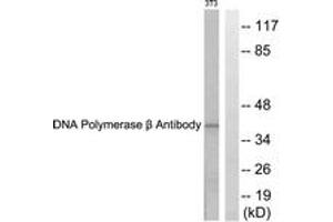 Western blot analysis of extracts from NIH-3T3 cells, using DNA Polymerase beta Antibody. (POLB Antikörper  (AA 286-335))