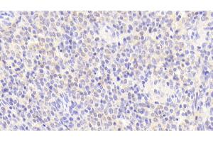 Immunohistochemistry (IHC) image for anti-Heparan Sulfate Proteoglycan 2 (HSPG2) (AA 4149-4391) antibody (ABIN7435115)