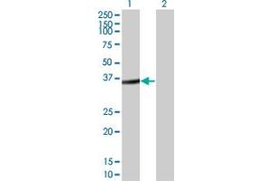 Western Blot analysis of FRZB expression in transfected 293T cell line by FRZB monoclonal antibody (M05), clone 1H8. (FRZB Antikörper  (AA 102-190))