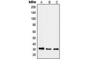 Western blot analysis of RAB40B expression in HeLa (A), mouse lung (B), rat heart (C) whole cell lysates.