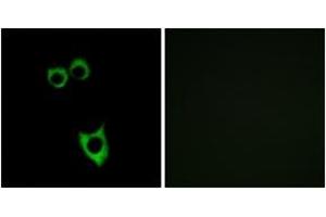 Immunofluorescence analysis of MCF7 cells, using VIPR2 Antibody. (VIPR2 Antikörper)