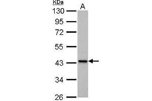 WB Image IVD antibody detects IVD protein by Western blot analysis. (IVD Antikörper)