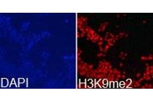 Immunofluorescence analysis of 293T cell using H3K9me2 antibody. (Histone 3 Antikörper  (H3K9me2))
