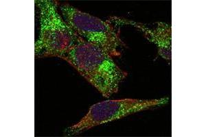Confocal immunofluorescence analysis of Hela cells using INHA antibody (green). (Inhibin alpha Antikörper)