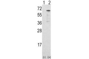 Western blot analysis of CAMKK1 antibody and 293 cell lysate either nontransfected (Lane 1) or transiently transfected with the CAMKK1 gene (2). (CAMKK1 Antikörper  (AA 337-369))
