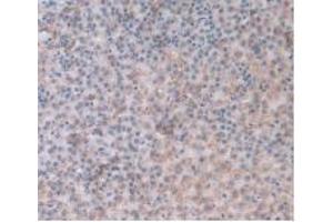 IHC-P analysis of Rat Adrenal Gland Tissue, with DAB staining. (ORM1 Antikörper  (AA 19-186))