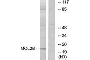Western blot analysis of extracts from COLO cells, using MOBKL2B Antibody. (MOBKL2B Antikörper  (AA 71-120))