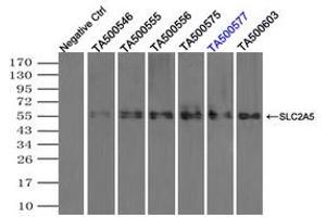 Image no. 1 for anti-Solute Carrier Family 2 (Facilitated Glucose/fructose Transporter), Member 5 (SLC2A5) antibody (ABIN1498477) (SLC2A5 Antikörper)