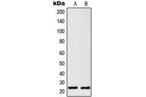 Western blot analysis of RAN expression in HeLa (A), A431 (B) whole cell lysates. (RAN Antikörper  (C-Term))