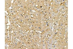 ABIN7096880 and ABIN7100946 at 1/100 staining rat heart tissue by IHC-P.