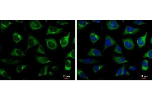 ICC/IF Image RRM2 antibody [N1C1] detects RRM2 protein at cytoplasm by immunofluorescent analysis. (RRM2 Antikörper  (Regulatory Subunit))