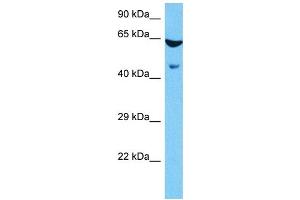 Host:  Mouse  Target Name:  ESRRG  Sample Tissue:  Mouse Brain  Antibody Dilution:  1ug/ml (ESRRG Antikörper  (Middle Region))