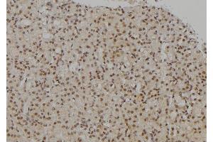 Immunohistochemistry (IHC) image for anti-Ubiquitin-Like with PHD and Ring Finger Domains 2, E3 Ubiquitin Protein Ligase (UHRF2) (Internal Region) antibody (ABIN6265881)