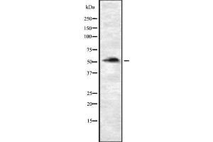 Western blot analysis of P4HTM using Jurkat whole cell lysates