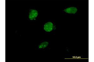 Immunofluorescence of monoclonal antibody to TSC22D4 on HeLa cell. (TSC22D4 Antikörper  (AA 1-395))