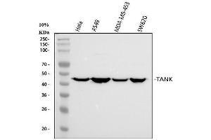 Western blot analysis of TANK using anti-TANK antibody (ABIN6719508). (TANK Antikörper)