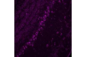 Immunohistochemistry (IHC) image for anti-Corticotropin Releasing Hormone (CRH) antibody (ABIN7456343) (CRH Antikörper)