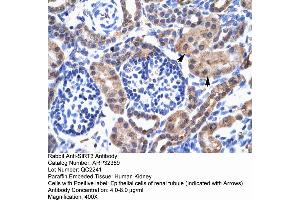Immunohistochemistry (IHC) image for anti-Sirtuin 3 (SIRT3) (C-Term) antibody (ABIN2779610)