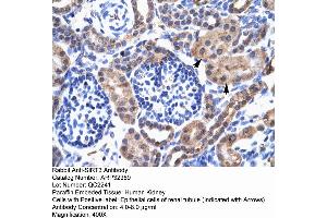 Human kidney (SIRT3 Antikörper  (C-Term))