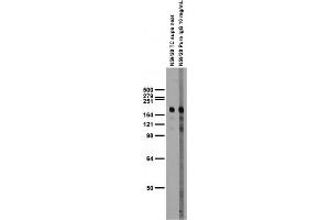 Immunoblots on brain membranes prepared from whole rat.