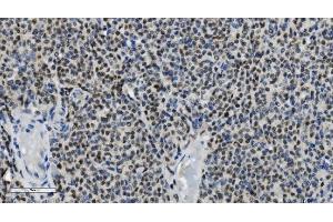 IHC analysis of PARP using anti-PARP antibody (ABIN7602278). (PARP1 Antikörper  (AA 670-858))